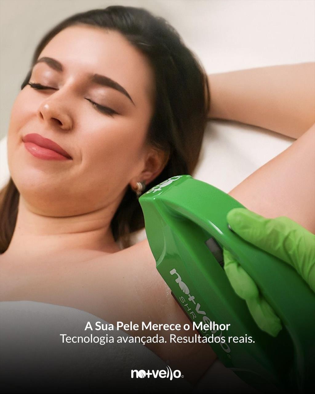 No+Vello, um franchising de estética com baixo investimento e elevado potencial