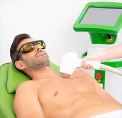 Depilação a laser díodo para homens: Por que cada vez mais homens optam por este tipo de depilação?